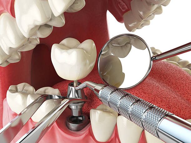 Dentist for Dental Trauma in GA